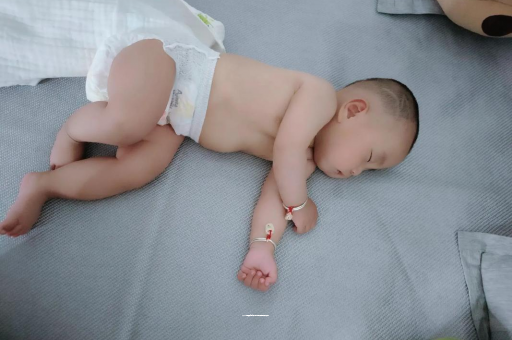 宜阳六个月宝宝眼睛散光